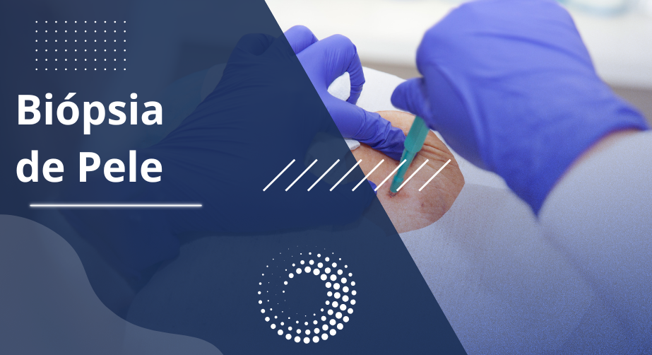 biopsia-da-pele
